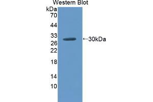 Figure. (SCNN1G anticorps  (AA 1-182))