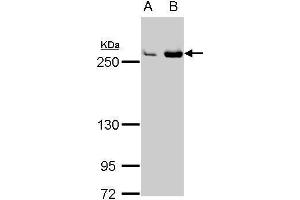 WB Image Fatty Acid Synthase antibody [N1], N-term detects FASN protein by Western blot analysis.