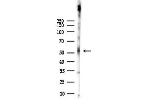 Western blot analysis of lysates from 293 cells(LPS 4h treatment), using E2F1 Antibody at 1/1000 dilution.
