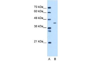 MTCH1 antibody used at 1 ug/ml to detect target protein.