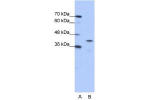 CPEB2 antibody used at 0. (CPEB2 anticorps  (Middle Region))