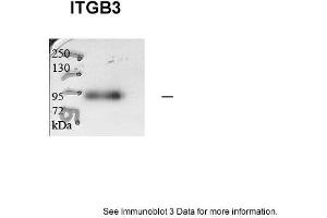 Sample type: human microvascular endothelial cells (25ug)Primary Dilution: 1:1000Secondary Antibody: Goat anti-Rabbit-HRPSecondary Dilution: 1:5000Image Submitted by: Andreas Eisenreich Charite Universitatsmedizin Berlin