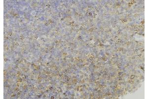 ABIN6274038 at 1/100 staining Human lymph node tissue by IHC-P. (Melanoma gp100 anticorps  (C-Term))