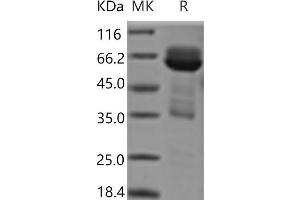 Western Blotting (WB) image for Cell Adhesion Molecule 3 (CADM3) protein (Fc Tag) (ABIN7321188)