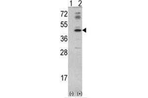 Western blot analysis of MVD (arrow) using rabbit polyclonal MVD Antibody (N-term) .