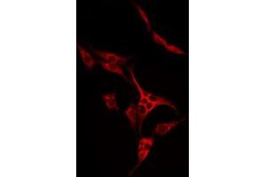 ABIN6274977 staining LOVO by IF/ICC. (SLC7A4 anticorps  (C-Term))