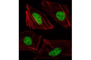 Fluorescent image of HUVEC cell stained with TBX15 Antibody (N-term). (T-Box 15 anticorps  (N-Term))