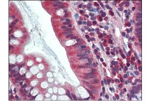 Human Small Intestine: Formalin-Fixed, Paraffin-Embedded (FFPE) (CA1 anticorps  (Internal Region))