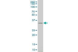 SIX3 monoclonal antibody (M02), clone 3F1 Western Blot analysis of SIX3 expression in 293 . (SIX3 anticorps  (AA 273-332))