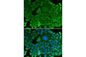 Immunofluorescence analysis of HeLa cells using RhoGDI antibody (ABIN3021743, ABIN3021744, ABIN3021745 and ABIN1512595).