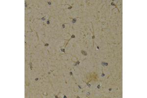 Immunohistochemistry (IHC) image for anti-Arachidonate 5-Lipoxygenase (ALOX5) (AA 1-300) antibody (ABIN3023073)