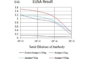 Black line: Control Antigen (100 ng),Purple line: Antigen (10 ng), Blue line: Antigen (50 ng), Red line:Antigen (100 ng)