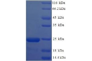 OV16 (AA 17-197) protein (His tag)