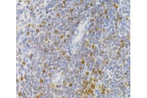 Immunohistochemistry of paraffin-embedded Rat spleen using NASP Polyclonal Antibody at dilution of 1:100 (40x lens). (NASP anticorps)
