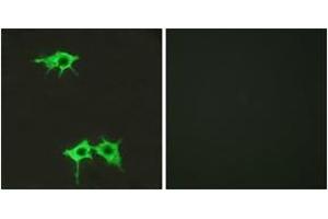 Immunofluorescence analysis of LOVO cells, using FZD4 Antibody. (FZD4 anticorps  (AA 131-180))
