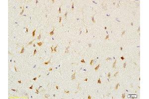 Formalin-fixed and paraffin embedded: rat brain tissue labeled with Anti-CNP/CNPase Polyclonal Antibody , Unconjugated at 1:200, followed by conjugation to the secondary antibody and DAB staining