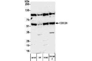 Western Blotting (WB) image for anti-Cell Division Cycle 20 Homolog (S. Cerevisiae) (CDC20) (AA 449-499) antibody (ABIN7454724) (CDC20 anticorps  (AA 449-499))