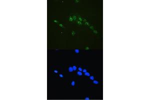 IF analysis of CBFb using anti-CBFb antibody (ABIN5693076).