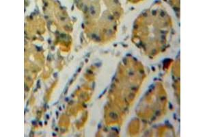 Used in DAB staining on fromalin fixed paraffin-embedded Stomach tissue