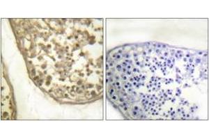 Immunohistochemistry analysis of paraffin-embedded human testis, using c-Jun (Phospho-Thr231) Antibody. (C-JUN anticorps  (pThr231))