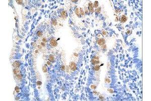 Image no. 1 for anti-TEA Domain Family Member 3 (TEAD3) (C-Term) antibody (ABIN6736262)