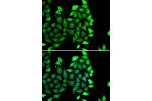 Immunofluorescence analysis of MCF7 cell using IKZF3 antibody. (IKZF3 anticorps)