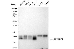 Western blotting analysis using EIF4EBP1 antibody (ABIN7798531).