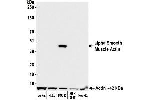 Western Blotting (WB) image for anti-Actin, alpha 2, Smooth Muscle, Aorta (ACTA2) (AA 1-50) antibody (ABIN7449438)