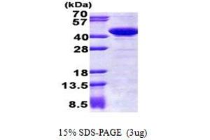 SDS-PAGE (SDS) image for Starch Binding Domain 1 (STBD1) (AA 24-358) protein (His tag) (ABIN5853075) (STBD1 Protein (AA 24-358) (His tag))