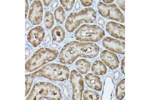 Immunohistochemistry of paraffin-embedded rat kidney using MLST8 Rabbit pAb (ABIN6131371, ABIN6143894, ABIN6143895 and ABIN6217660) at dilution of 1:100 (40x lens).