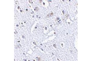 Immunohistochemistry of TIGAR in human brain tissue with TIGAAP30878PU-N at 2. (TIGAR anticorps  (Center))