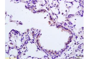 Formalin-fixed and paraffin embedded rat lung labeled with Rabbit Anti APAF1(NT) Polyclonal Antibody, Unconjugated (ABIN724310) at 1:200 followed by conjugation to the secondary antibody and DAB staining (APAF1 anticorps  (AA 13-80))