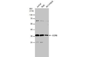 WB Image Various whole cell extracts (30 μg) were separated by 10% SDS-PAGE, and the membrane was blotted with CCR5 antibody , diluted at 1:500. (CCR5 anticorps  (Center))