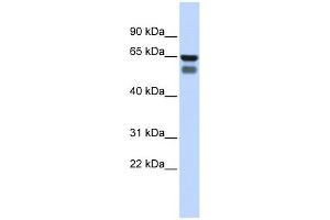GALNT4 antibody used at 1 ug/ml to detect target protein. (GALNT4 anticorps)
