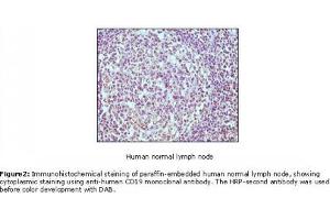 Image no. 1 for anti-CD19 Molecule (CD19) antibody (ABIN207604) (CD19 anticorps)