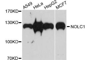 Western blot analysis of extracts of various cells, using NOLC1 antibody. (NOLC1 anticorps)