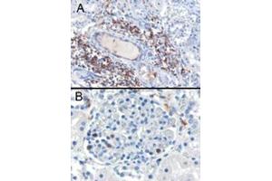 Image no. 1 for anti-SH3-Domain Binding Protein 1 (SH3BP1) (C-Term) antibody (ABIN374404) (SH3BP1 anticorps  (C-Term))