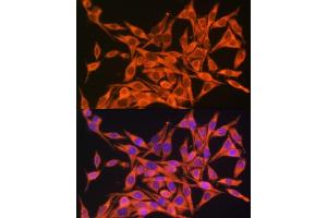 Immunofluorescence analysis of HeLa cells using MT- antibody (ABIN7268594) at dilution of 1:100.