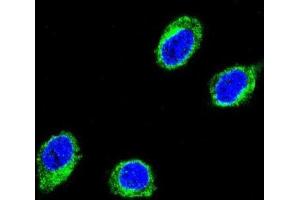 Immunofluorescence (IF) image for anti-Coiled-Coil alpha-Helical Rod Protein 1 (CCHCR1) antibody (ABIN3003788)