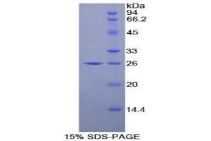 SDS-PAGE analysis of Mouse LMP7 Protein.