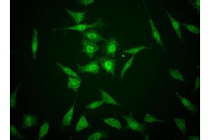 Immunofluorescent staining of human cell lines. (TAZ anticorps)