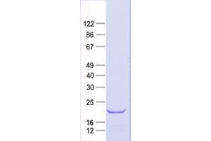 Validation with Western Blot