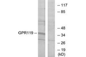 Western blot analysis of extracts from K562 cells, using GPR119 Antibody. (G Protein-Coupled Receptor 119 anticorps  (AA 186-235))