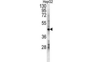 Western Blotting (WB) image for anti-Lactate Dehydrogenase D (LDHD) antibody (ABIN3002427) (LDHD anticorps)