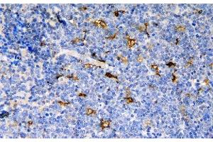 IHC analysis of CCR6 using anti-CCR6 antibody (ABIN7603110). (CCR6 anticorps  (N-Term))