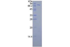 SDS-PAGE analysis of Human FKBP5 Protein. (FKBP5 Protéine)