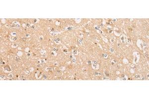 Immunohistochemistry of paraffin-embedded Human brain tissue using C15orf40 Polyclonal Antibody at dilution of 1:30(x200) (C15orf40 anticorps)