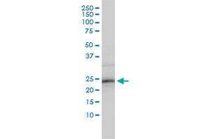 ZNF313 monoclonal antibody (M01), clone 4G3-1A10 Western Blot analysis of ZNF313 expression in HepG2 .