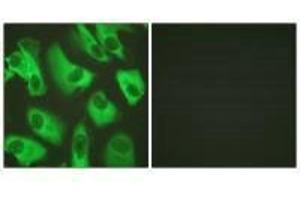 Immunofluorescence analysis of HeLa cells, using Kir5.