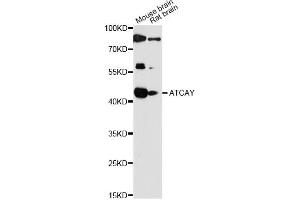 Western blot analysis of extracts of various cell lines, using ATCAY antibody (ABIN6292798) at 1:1000 dilution. (ATCAY anticorps)